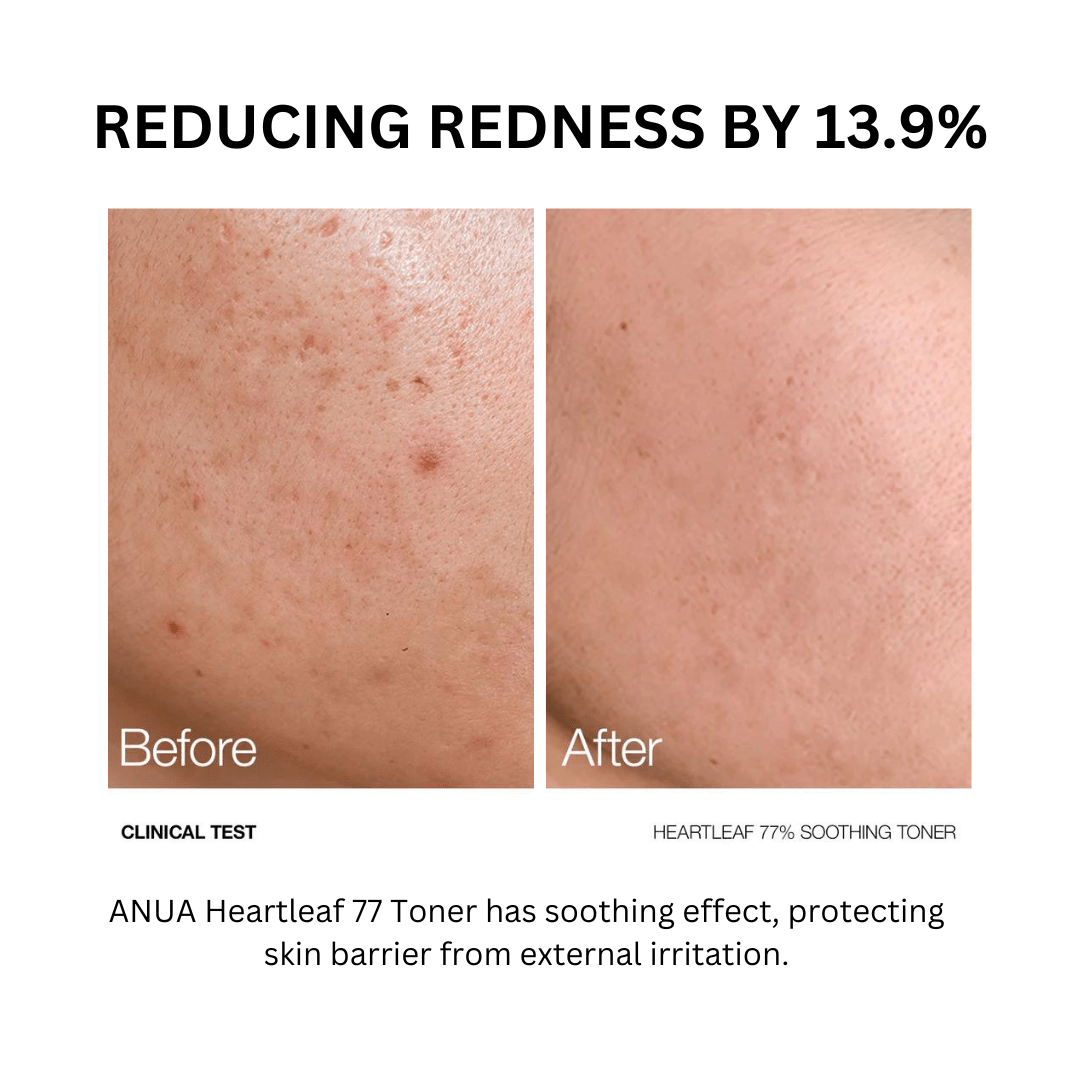 Anua - Heartleaf 77% Soothing Toner - DewDropShopDewDropShop